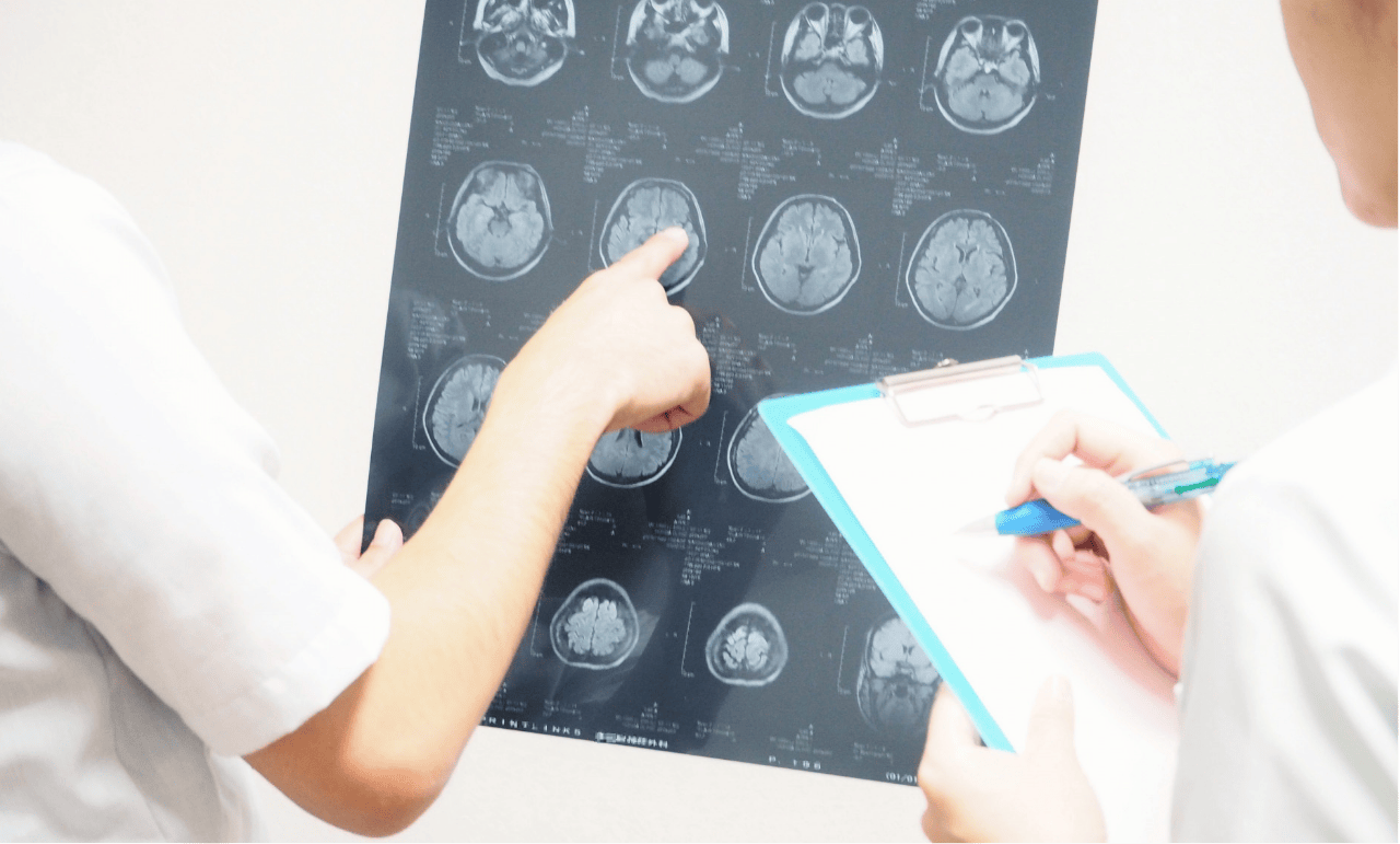 脳神経内科のご案内